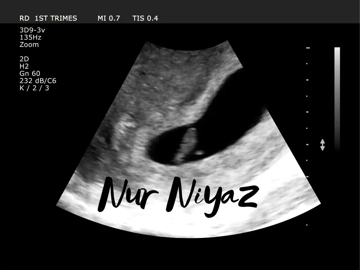 Nur Niyaz'ın Hamilelik Günlüğü: 1. Trimester